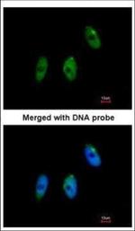 ELP3 Polyclonal Antibody