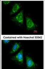PAN3 Antibody in Immunocytochemistry (ICC/IF)