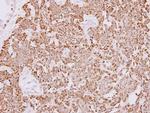 PAN3 Antibody in Immunohistochemistry (Paraffin) (IHC (P))
