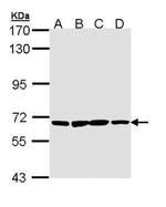 PAN3 Antibody in Western Blot (WB)