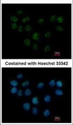 SMC1B Polyclonal Antibody