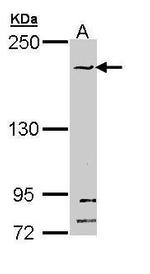 SMC1B Antibody in Western Blot (WB)