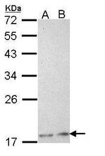 PLA2G12A Polyclonal Antibody