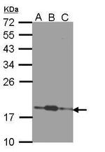COMMD7 Antibody in Western Blot (WB)