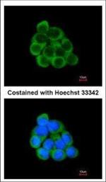 PECR Polyclonal Antibody