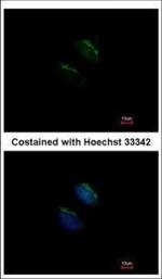 MGAT3 Polyclonal Antibody