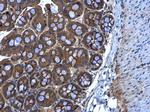 MGAT3 Antibody in Immunohistochemistry (Paraffin) (IHC (P))