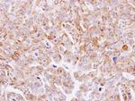 MGAT3 Antibody in Immunohistochemistry (Paraffin) (IHC (P))