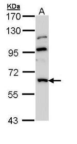 MGAT3 Antibody in Western Blot (WB)