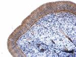 CTNNAL1 Antibody in Immunohistochemistry (Paraffin) (IHC (P))