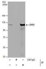 ZHX2 Antibody in Immunoprecipitation (IP)
