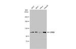 ZHX2 Antibody in Western Blot (WB)