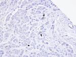 TRPM2 Antibody in Immunohistochemistry (Paraffin) (IHC (P))