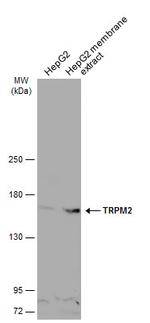 TRPM2 Antibody in Western Blot (WB)