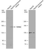 TRPM2 Antibody in Western Blot (WB)