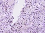 EED Antibody in Immunohistochemistry (Paraffin) (IHC (P))