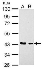 EED Antibody in Western Blot (WB)