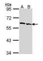 TCP-1 beta Antibody in Western Blot (WB)