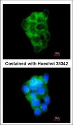 PPFIBP2 Polyclonal Antibody