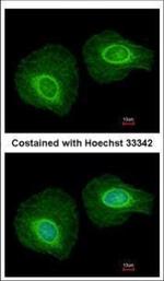 Cytokeratin 34 Polyclonal Antibody