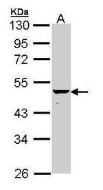 Cytokeratin 34 Antibody in Western Blot (WB)