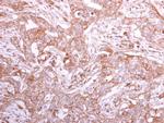 GMDS Polyclonal Antibody