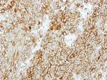 GMDS Antibody in Immunohistochemistry (Paraffin) (IHC (P))