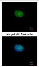RBPJ Polyclonal Antibody