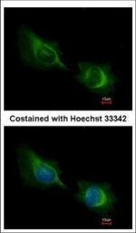 DTX1 Antibody in Immunocytochemistry (ICC/IF)