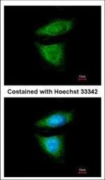 DYNC1I2 Polyclonal Antibody