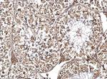DYNC1I2 Antibody in Immunohistochemistry (Paraffin) (IHC (P))