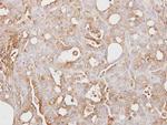 ITIH3 Antibody in Immunohistochemistry (Paraffin) (IHC (P))