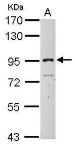 ITIH3 Antibody in Western Blot (WB)