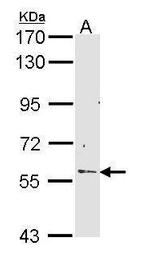 RCBTB2 Antibody in Western Blot (WB)