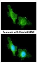 CNGA2 Antibody in Immunocytochemistry (ICC/IF)