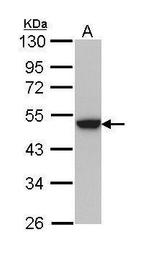 Cytokeratin 31 Polyclonal Antibody
