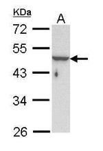Cytokeratin 33B Polyclonal Antibody