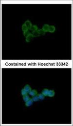 DLST Polyclonal Antibody