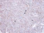 CAP1 Polyclonal Antibody