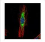 SCIN Polyclonal Antibody