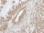 Pancreatic Amylase Polyclonal Antibody