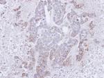 BTLA Polyclonal Antibody