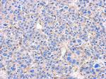 Alpha-Smooth Muscle Actin Antibody in Immunohistochemistry (IHC)