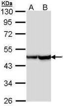 Alpha-Smooth Muscle Actin Antibody in Western Blot (WB)