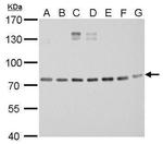 XPB Antibody in Western Blot (WB)