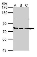 XPB Antibody in Western Blot (WB)