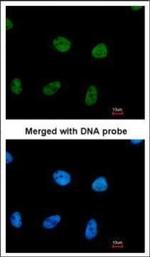RPA2 Antibody in Immunocytochemistry (ICC/IF)