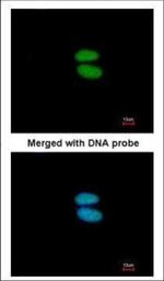 alpha Actinin 4 Antibody in Immunocytochemistry (ICC/IF)