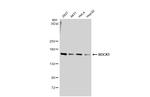 ROCK1 Antibody in Western Blot (WB)