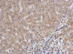 RACGAP1 Antibody in Immunohistochemistry (Paraffin) (IHC (P))